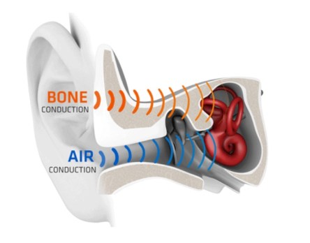 boneconduction